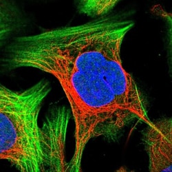PRKRIP1 Antibody, Novus Biologicals 0.1mL; Unlabeled:Antibodies, Polyclonal